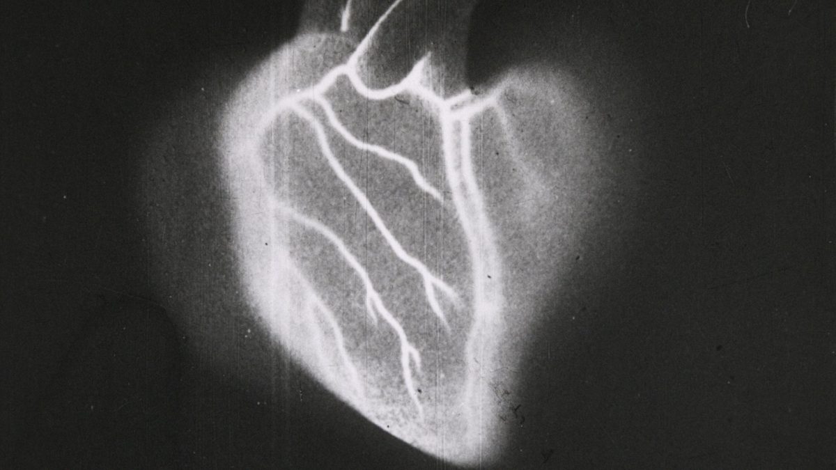 Turning Points: Europa - kadr 1