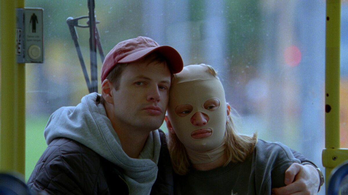 Chłopak przytula swoją dziewczynę w tramwaju, kobieta ma bandaże na twarzy.