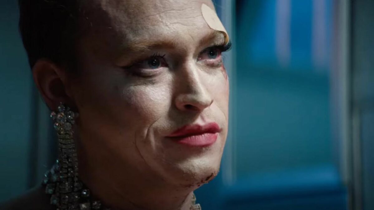 Zbliżenie na twarz młodego chłopka, ma plaster i jest poobijany.